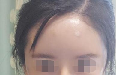 ���w֬�����̫�Ѩ���g(sh��)׌�ҵ��^������������