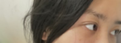 原來改善雙眼皮之后可以變得這么美