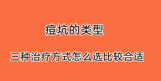 ѡ���ʺ��Լ��ģ��޸�����������ʵ�ܼ�