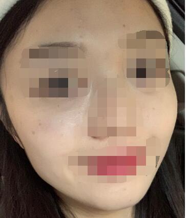 ����Ƥ�w�������g(sh��)Ƥ�w�񡰴��}����һ��ˮ�`