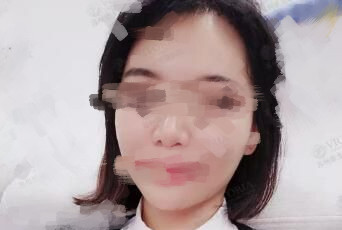 ���ּy��ʧ����Ƥ�wҲ׃�ü�(x��)ā����(l��i)