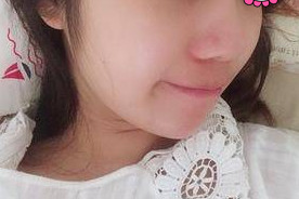 皮膚松弛選擇熱瑪吉準(zhǔn)沒錯