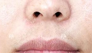 ���������ë���沿��׃�øɃ�������