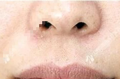 ���������ë���沿��׃�øɃ�������