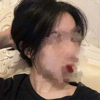 做個(gè)發(fā)際線種植手術(shù)讓我的氣質(zhì)彰顯出來(lái)