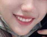 ���X�C�����g׌�ҵ����X׃������������