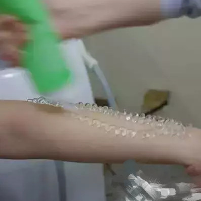 手臂脫毛,讓自己在夏季也能穿上喜歡的小吊帶