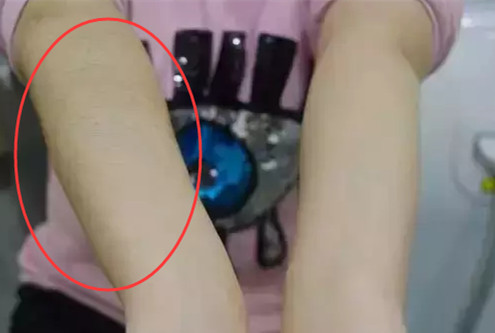 手臂脫毛,讓自己在夏季也能穿上喜歡的小吊帶