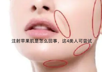 ע���O(p��ng)��������ô�������@4�(l��i)�˿ɇLԇ