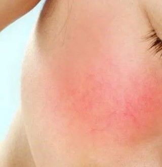 ����ҽ��һ�����tĘ��������ʲôԭ����ɵ�