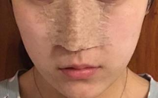 �m�Y(ji��)�ܾõıǲ�������g(sh��),��ؓ(f��)����Ч���ܺ�