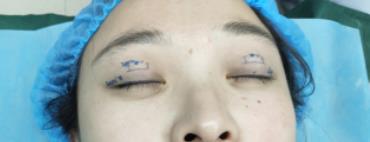 �p��Ƥ���g(sh��)�ޏ�(f��),׌�۾�����Ư��