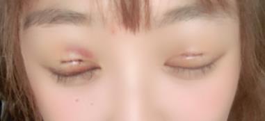 �p��Ƥ���g(sh��)�ޏ�(f��),׌�۾�����Ư��