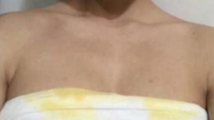 ���w֬��¡�����g(sh��)����:���g(sh��)�����������x�Ͳ�һ����