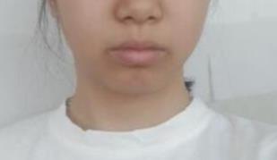 ���w֬���沿������g(sh��)����:�g(sh��)�����׃���˺ܶ�