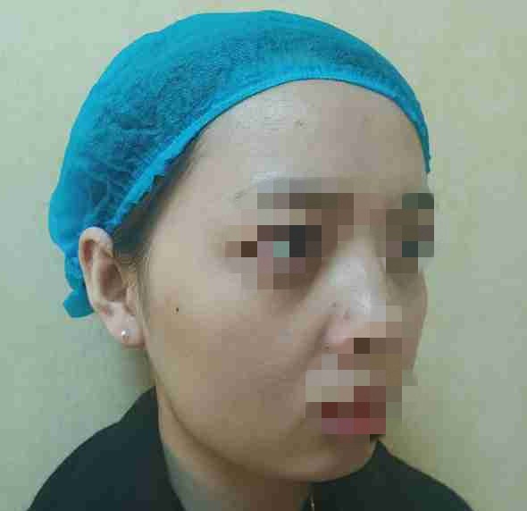 ������Ƥ֮��������ȥ��ĺ����p�����@����