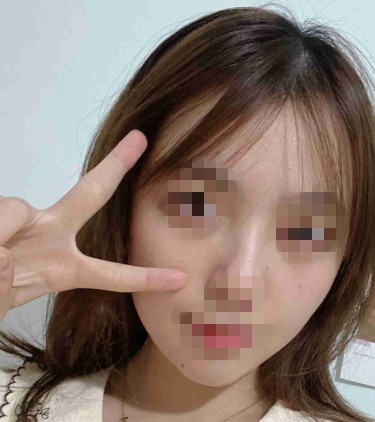 ������Ƥ֮�󣬿���ȥ��ĺ����p�����@����