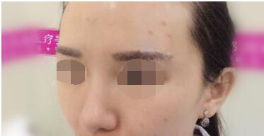 �S̫�(y��ng)Ѩ���g(sh��)׌�ҵ��沿��پ���������