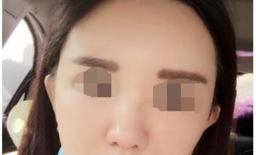 �S̫�(y��ng)Ѩ���g(sh��)׌�ҵ��沿��پ���������