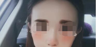 �S̫�(y��ng)Ѩ���g(sh��)׌�ҵ��沿��پ���������