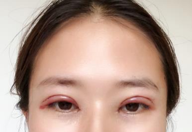 �p��Ƥ���g(sh��)����:�������������ѵ����]�������p��Ƥ���g(sh��)