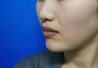 ��ܛ��¡�����g(sh��)����:���ӻ֏�(f��)�ܺ�׃Ư����