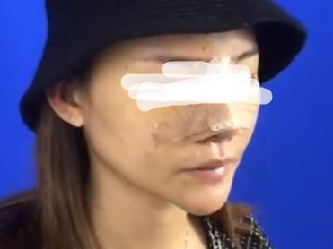 �ǲ��������g(sh��)����:�ڴ�����׃����������