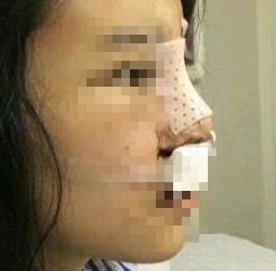 ���g(sh��)¡������֮���ϲ�g�F(xi��n)��