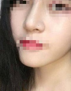 ���g(sh��)¡������֮���ϲ�g�F(xi��n)��