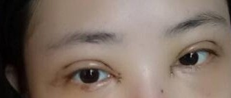 �](m��i)�뵽�����p��Ƥ��Ŀ��԰l(f��)���@ô��ĸ�׃