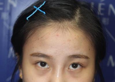 �p��Ƥ���g(sh��)����:��Ҫ׃������ȥ������������