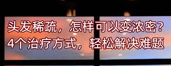 �^�l(f��)ϡ�裬���ӿ���׃������4��(g��)�ί���ʽ���p�ɽ�Q�y�}