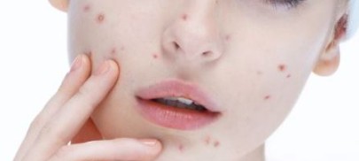 ��ʲôĘ�Ͽ����L�ഺ�����@�ׂ�ԭ����Ҫ������P(gu��n)��