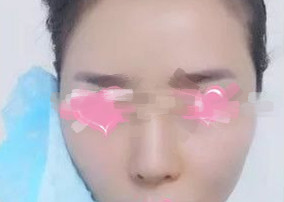 ��Ƥ�沿������׌Ę��׃�þ�������