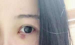 ����۴�Ч���ܲ��e����ͬ�g�����p�ܶ�