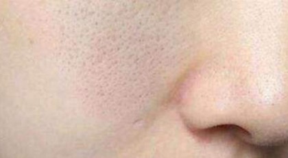 ë�״ִ�Ҫ�����@�����B(y��ng)���ۻ����׼�