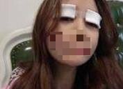 ȫ���p��Ƥ���g(sh��)����:�۾�׃�ø��Ӻÿ���