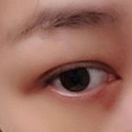 ���۴�ʧ���ޏ�(f��)���g(sh��)׌����p������ʮ��