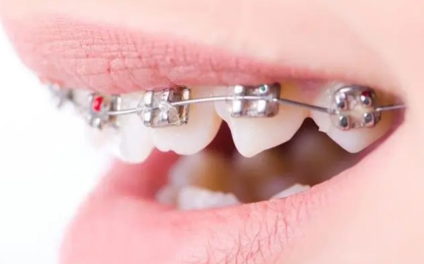 ���X���գ����X������4���ؽ�(j��ng)�A������֪����