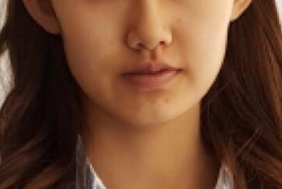 ���w֬���沿������g(sh��):Ę���Ĵ�׃��M����