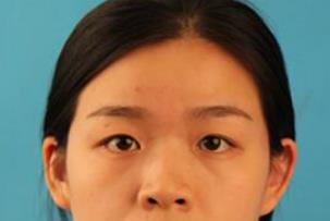 ȫ���p��Ƥ+�_��(n��i)�۽����g(sh��):�ʹ�ҷ����۾�׃�����^��