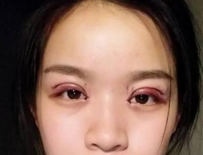 ȫ���p��Ƥ+�_��(n��i)�۽����g(sh��):�ʹ�ҷ����۾�׃�����^��