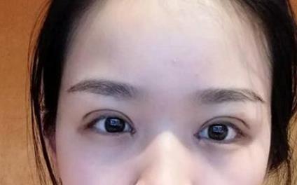 ȫ���p��Ƥ+�_��(n��i)�۽����g(sh��):�ʹ�ҷ����۾�׃�����^��