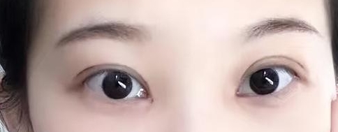 ���p��Ƥ�Ŀ������ğo���еă�(y��u)��