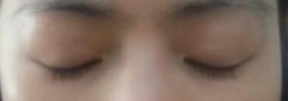 �p��Ƥ���g(sh��)��(j��ng)�v����:���g(sh��)���沿׃�ø�����