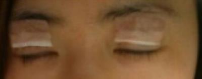 �p��Ƥ���g(sh��)��(j��ng)�v����:���g(sh��)���沿׃�ø�����