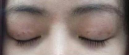 �p��Ƥ���g(sh��)��(j��ng)�v����:���g(sh��)���沿׃�ø�����