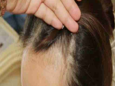 ���^�l(f��)���]�^�l(f��)�ą^(q��)�e̫���ˣ�ֲ�l(f��)��o����