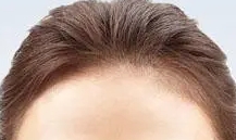 ��ͬĘ���m��ʲô�ӵİl(f��)�H���������l(f��)�H��̫���оȲ�