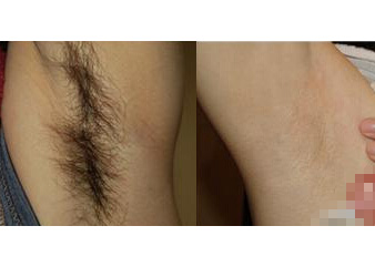 �ɶٱ�����ë